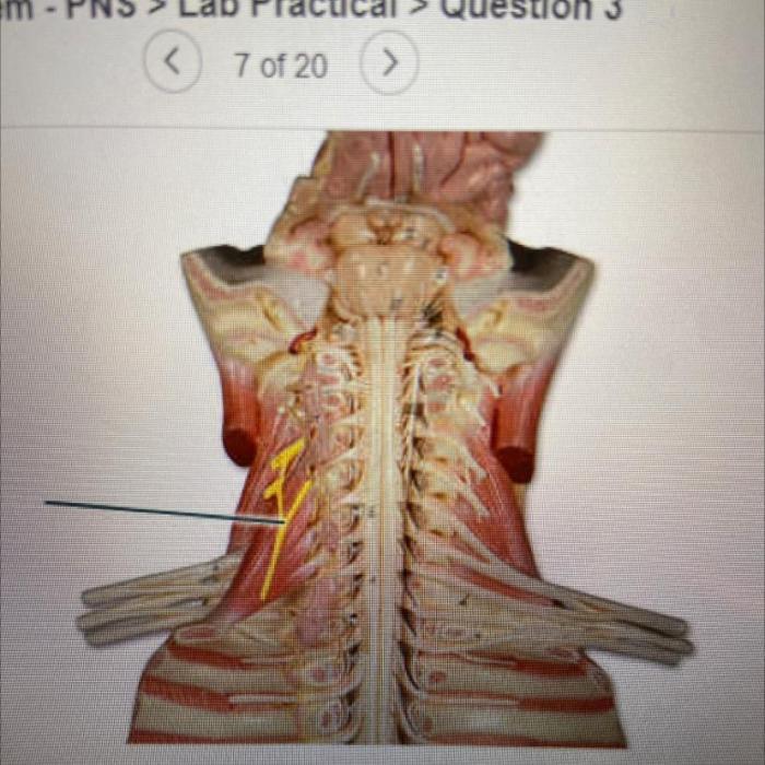 The highlighted structure is a component of which bone