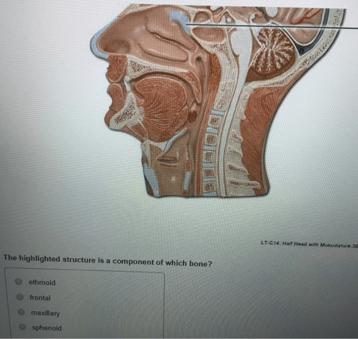 The highlighted structure is a component of which bone