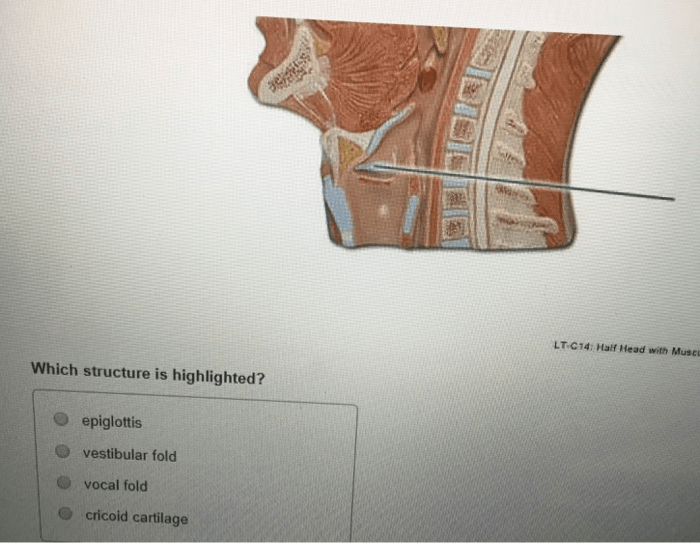 Nerve highlighted nervous practical pns question transcription